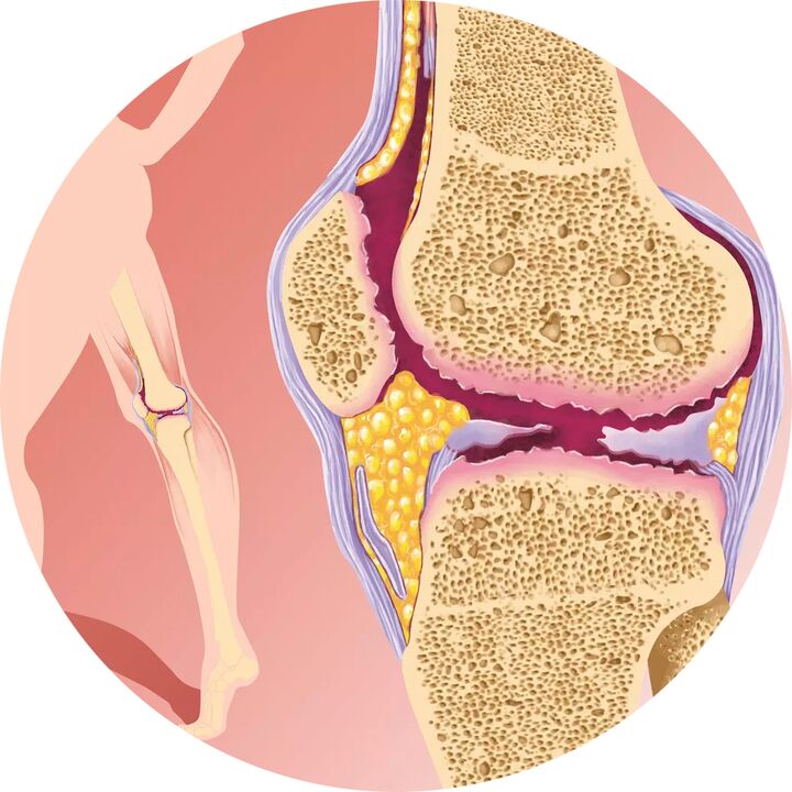 Hondroten - Ënnerstëtzt gemeinsame Mobilitéit