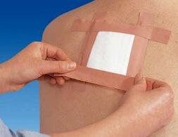 Benotzt e therapeutesche Patch fir Réckschmerzen