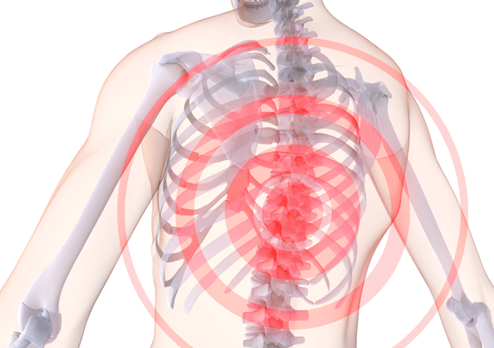 Osteochondrose vun der thoracic Wirbelsäule