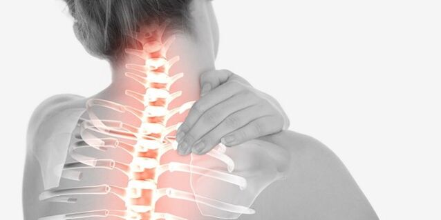 Hals Schmerz wéinst Osteochondrose